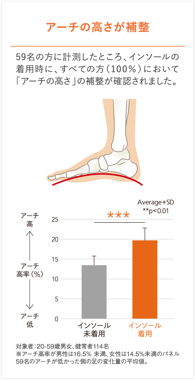 アーチの高さが補整