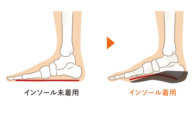 インソール未使用時とインソール直用事のイメージ