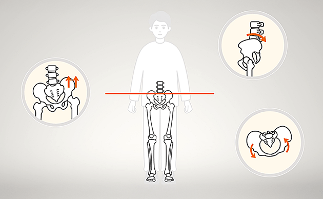 ゆがみのある足の骨の図