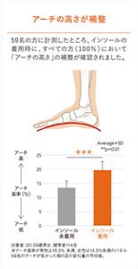 アーチの高さが補整